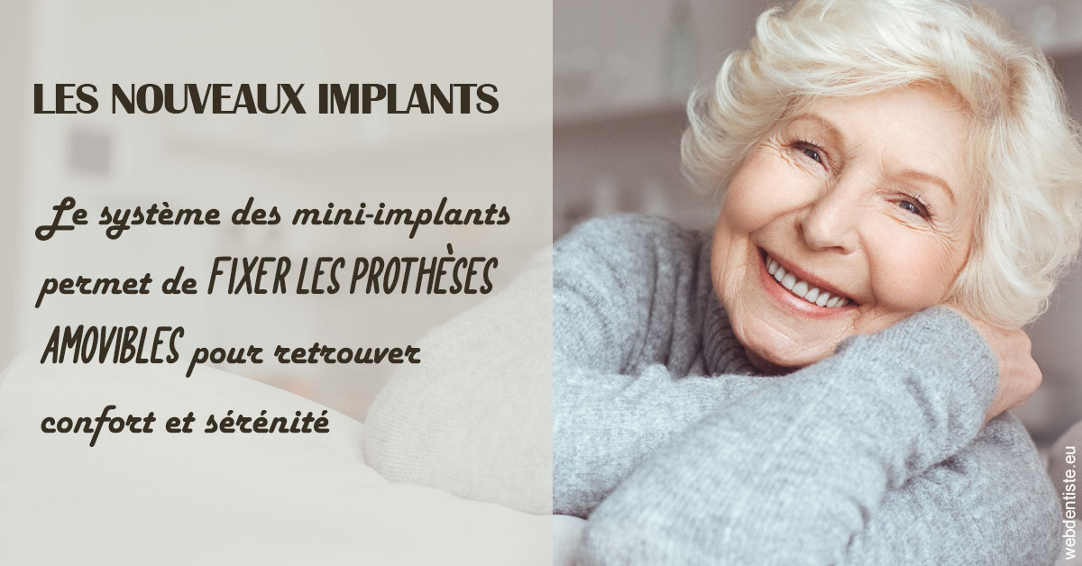 https://cabinetdentairemast.ch/Les nouveaux implants 1