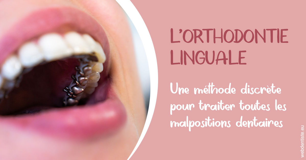 https://cabinetdentairemast.ch/L'orthodontie linguale 2
