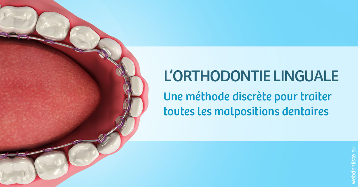 https://cabinetdentairemast.ch/L'orthodontie linguale 1