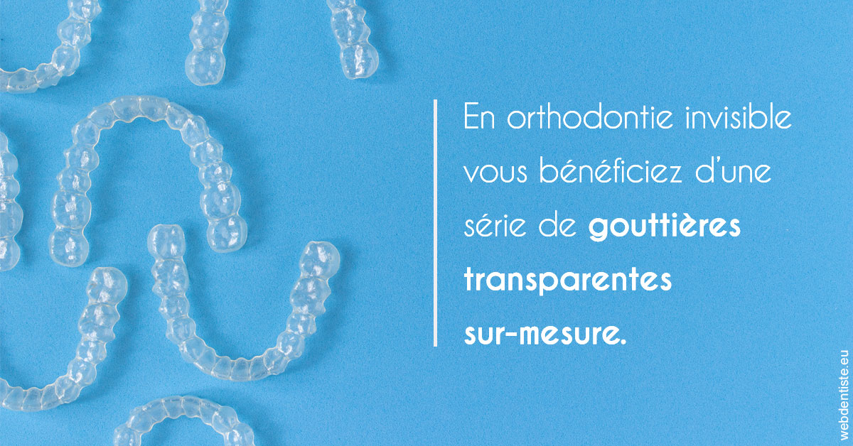 https://cabinetdentairemast.ch/Orthodontie invisible 2