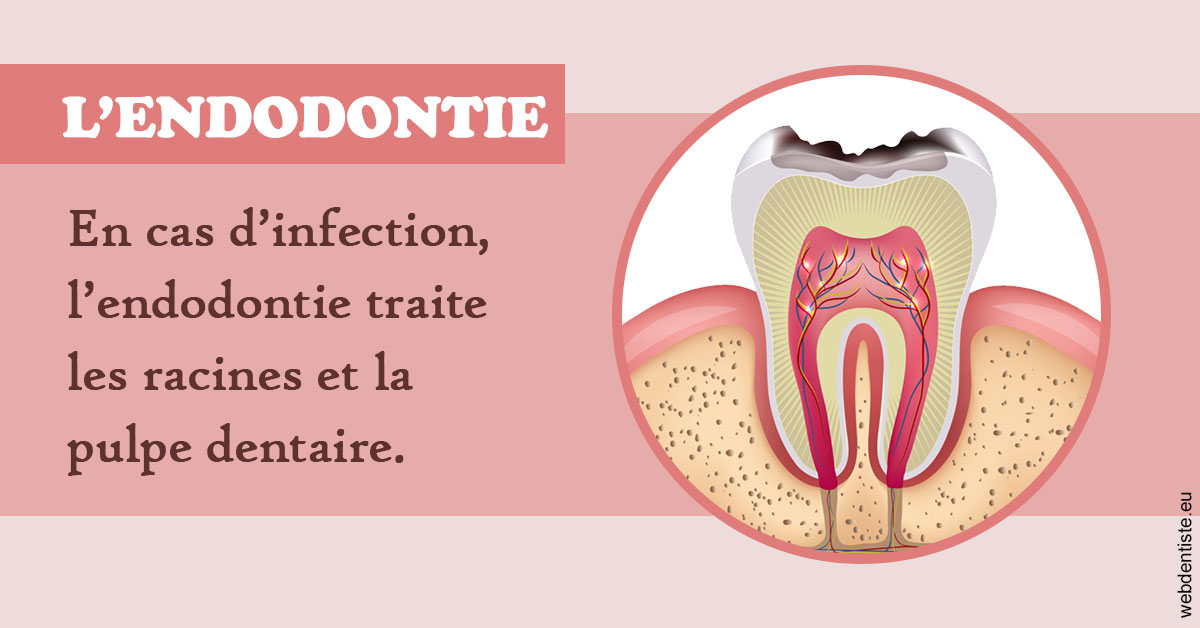 https://cabinetdentairemast.ch/L'endodontie 2