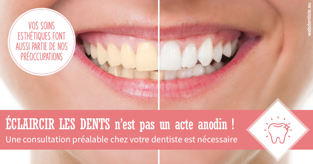 https://cabinetdentairemast.ch/Eclaircir les dents 1