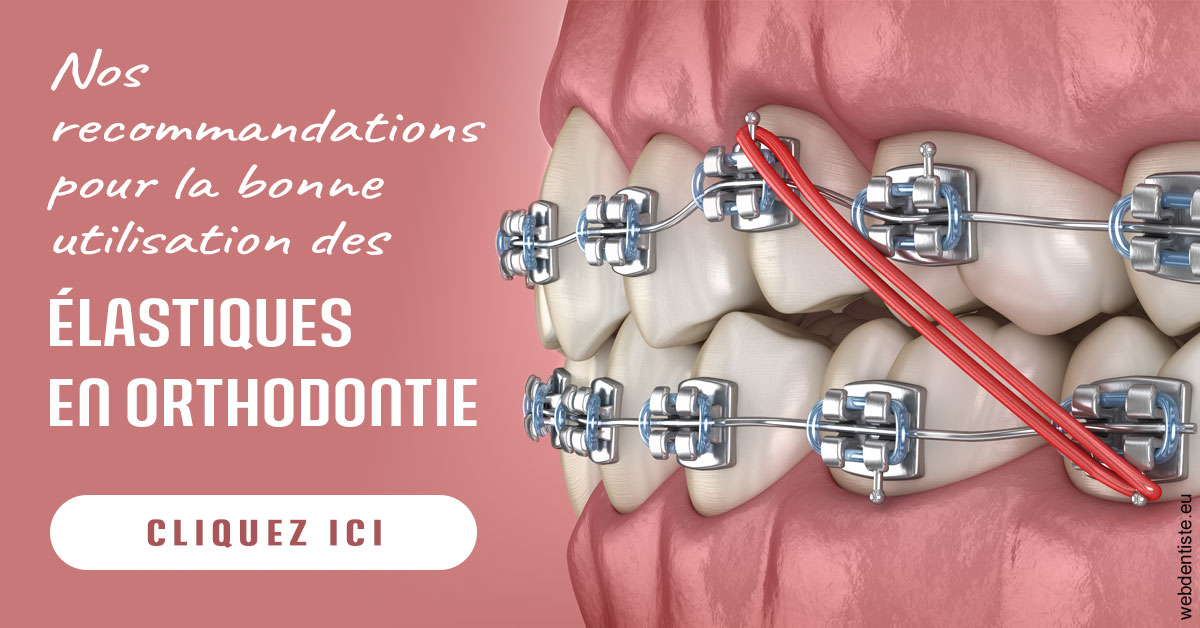 https://cabinetdentairemast.ch/Elastiques orthodontie 2